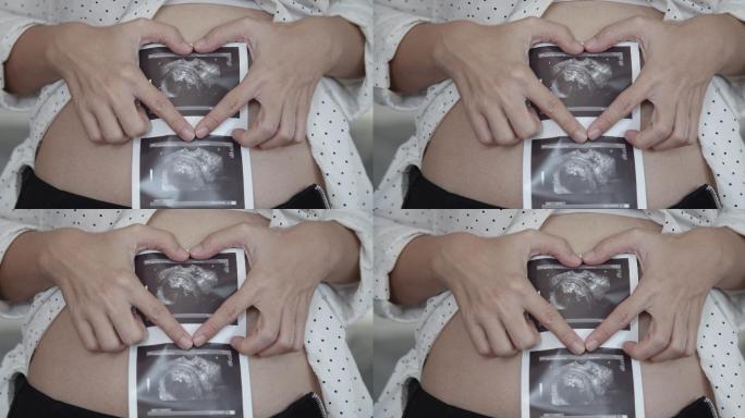 孕妇手拿三维超声图像