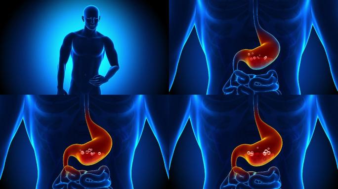胃痛-胃酸动画胃胀胃病胃癌胃酸胃炎