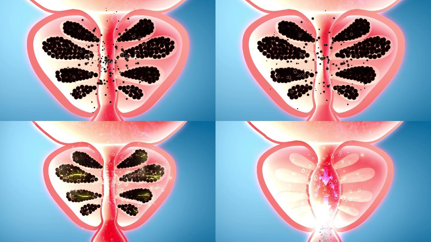 清空前列腺毒素排尿顺畅