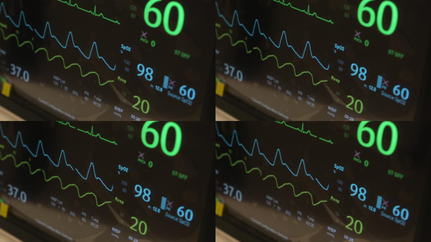 医疗监护仪显示面板心跳血压ICU