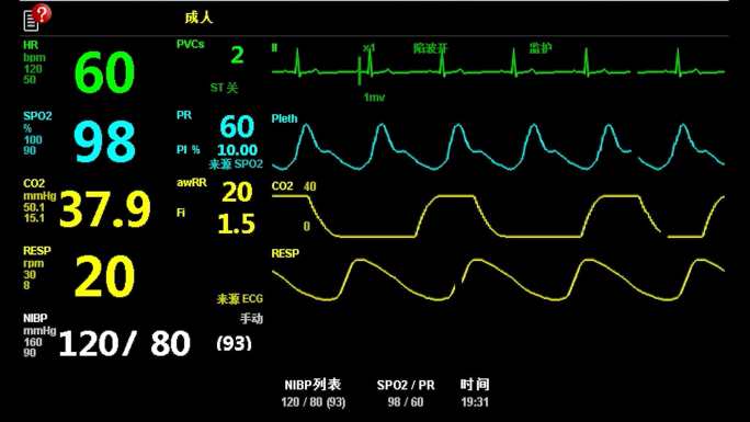 高清监护仪各项数据心跳呼吸体温