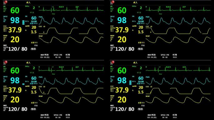 高清监护仪各项数据心跳呼吸体温