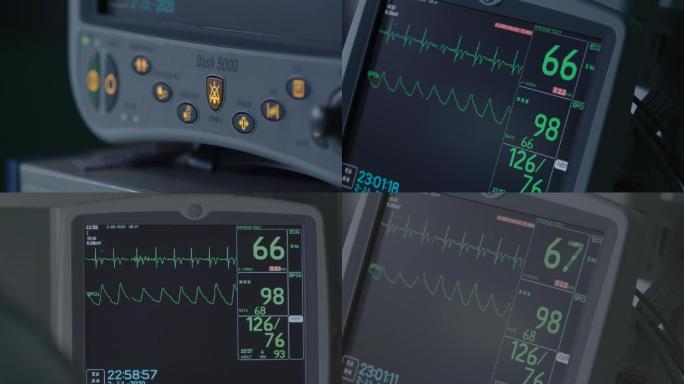 手术室空镜心率监护仪心电图心跳生命体征仪