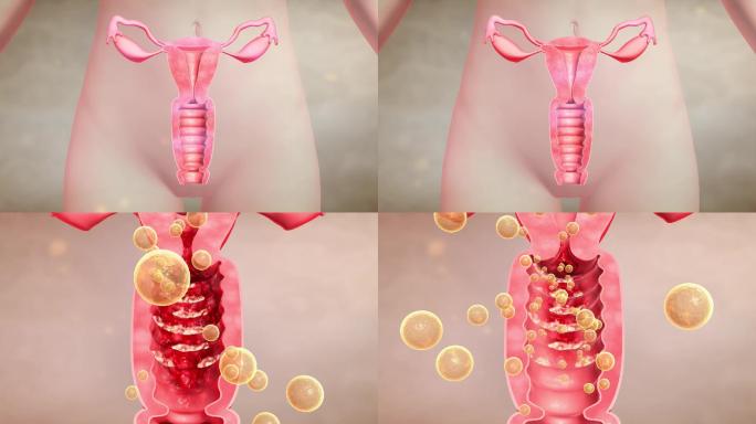 修复阴道 宫颈疾病 修复卵巢 药物因子
