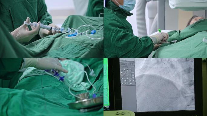 医院心脑血管介入手术治疗医疗设备