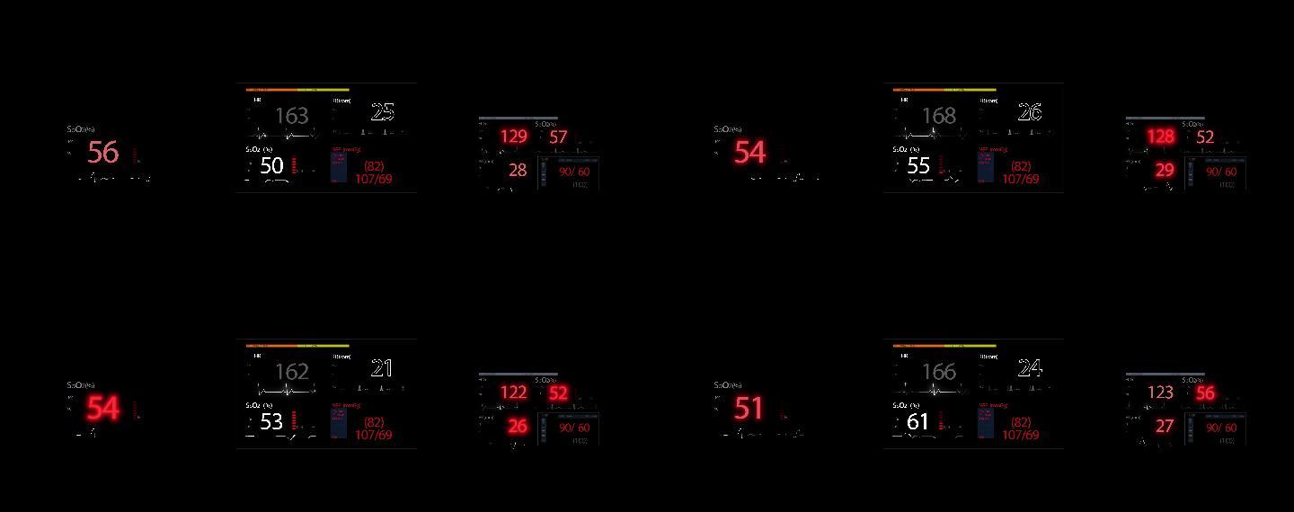 标准数值心电图新冠疫情医疗医院急救ICU