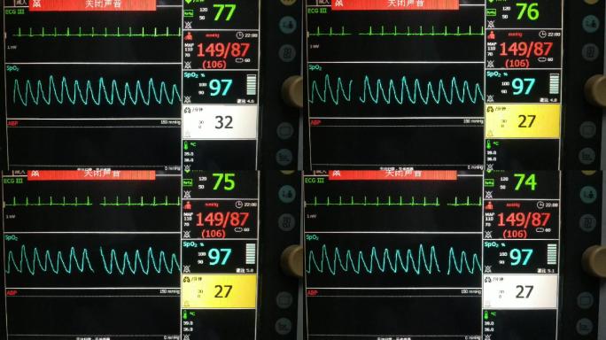 医院的心律监护仪