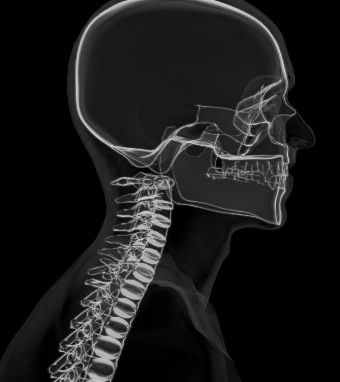 X光骨骼颈椎手部腰部