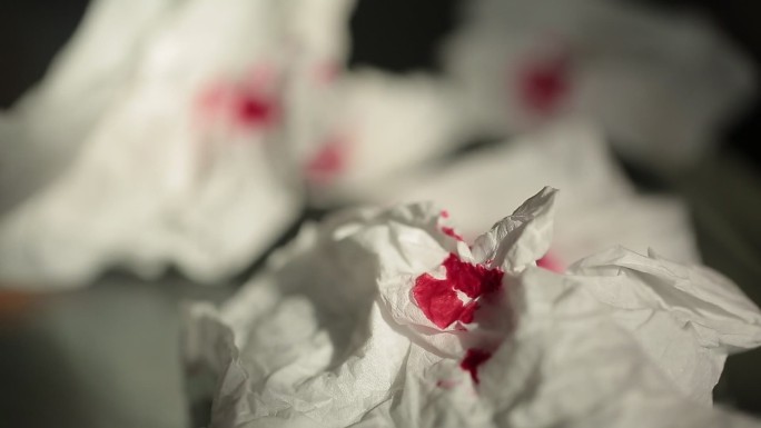 沾有血迹的纸巾 (7)