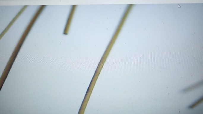 电子显微镜观察发丝毛鳞片 (2)