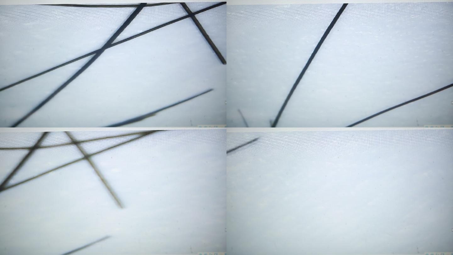 电子显微镜观察发丝毛鳞片 (1)
