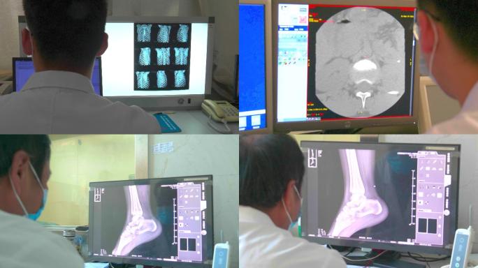 医生看透视片