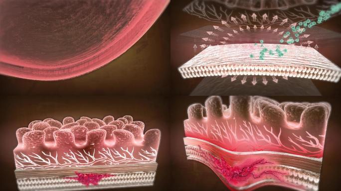 胃肠黏膜基损伤溃疡直至细胞发生变异癌变