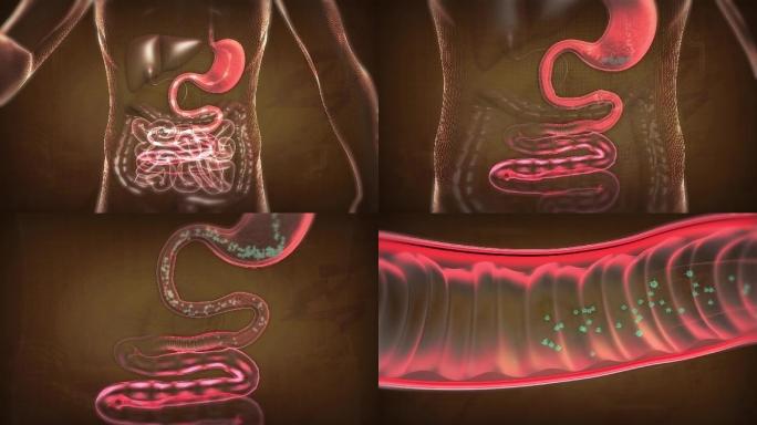 感染胃部的致病菌下行进入肠道腐蚀肠黏膜基