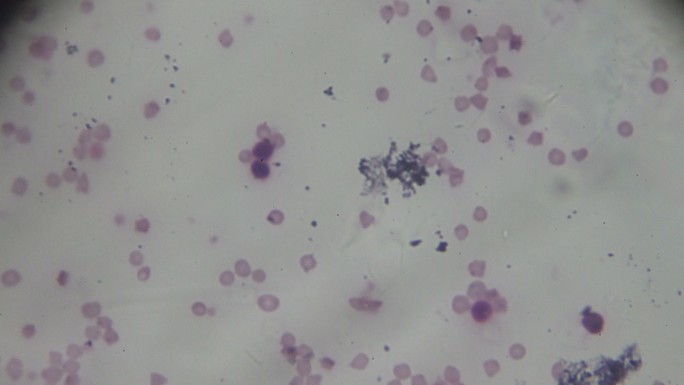 显微镜下红细胞与T免疫细胞连接