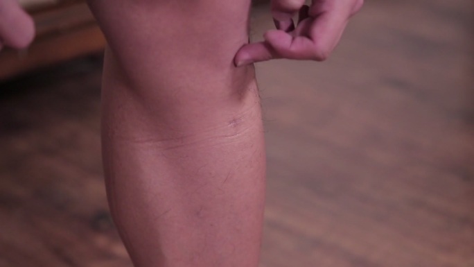 下肢膝盖穴位膝关节半月板 (5)