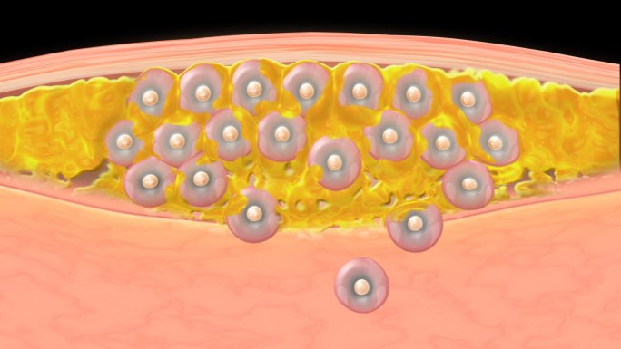 皮肤 细胞 脂肪分解