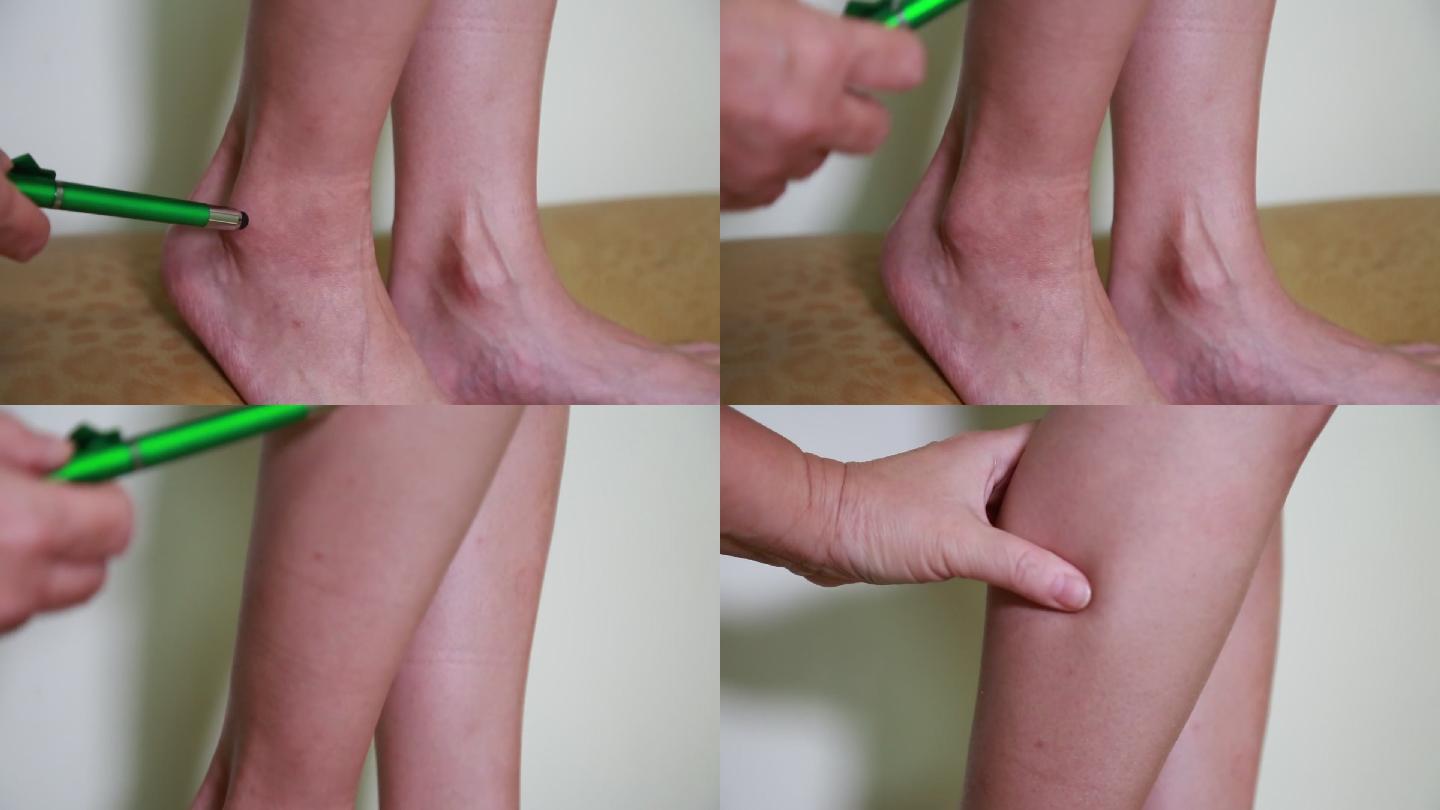 女性腿部穴位按摩膝盖 (7)