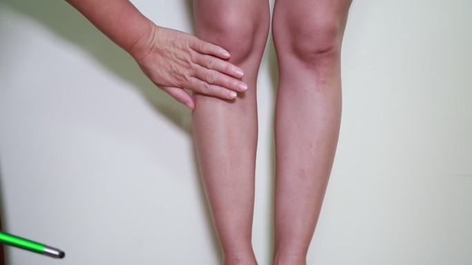 女性腿部穴位按摩膝盖 (2)