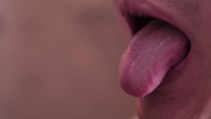舌苔口腔异味口臭上火 (1)