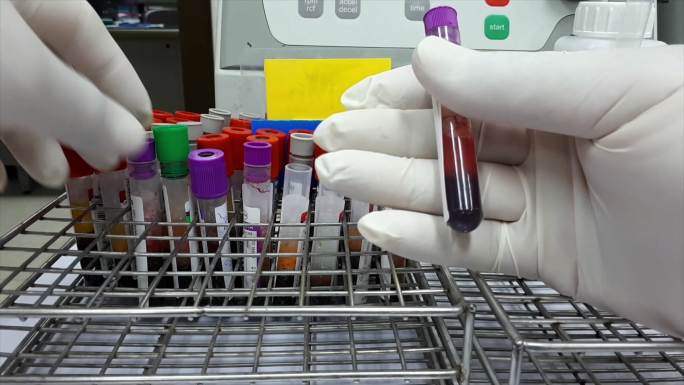 血液测试实验室设备