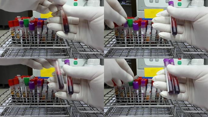 血液测试实验室设备