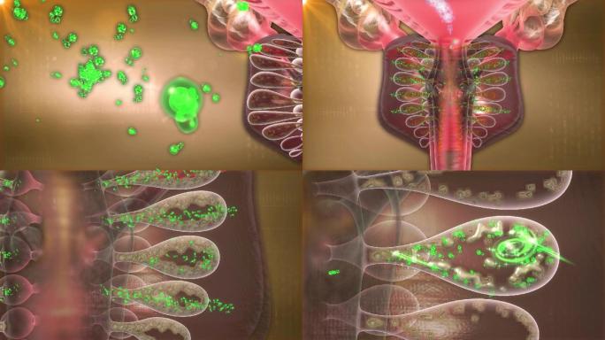药物入前列腺腺管上尿碱软化剥离随尿液排出