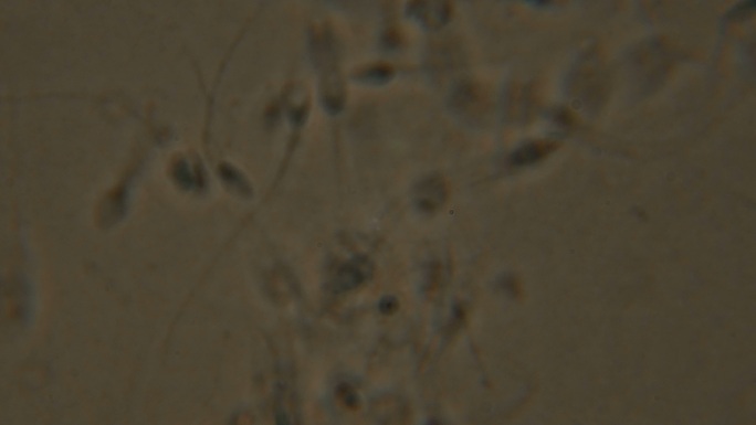 显微镜下观察的精子。