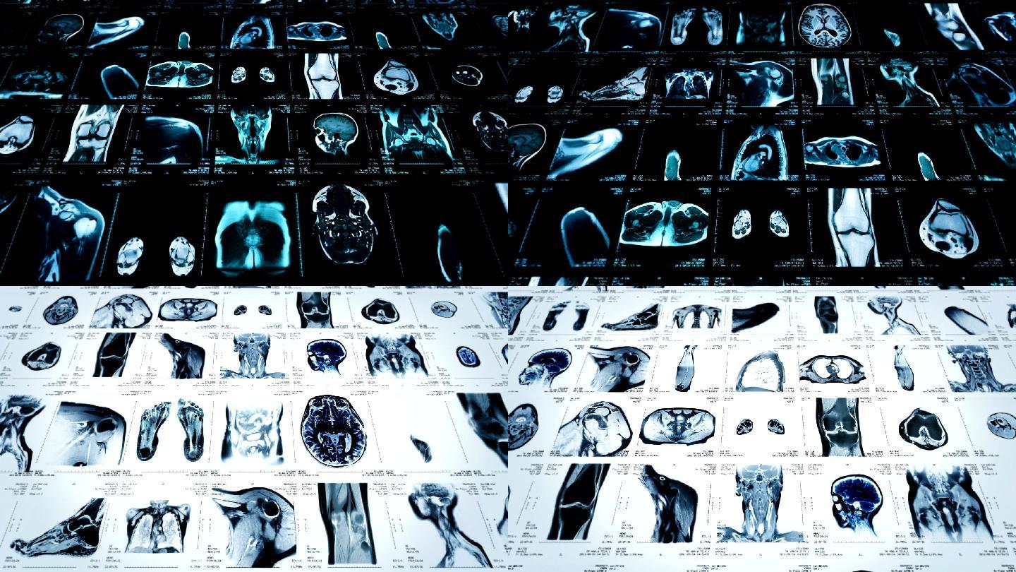 MRI视频墙。生物医学动画颞叶枕叶