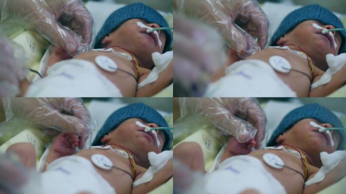 接受治疗的婴儿护士吸入观察