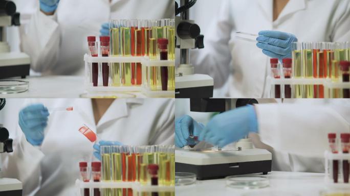 实验室科学家在显微镜下分析血样