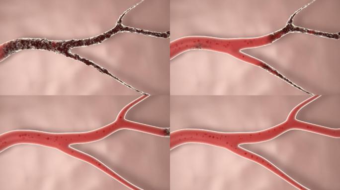 扩张修复微血管-改善微循环
