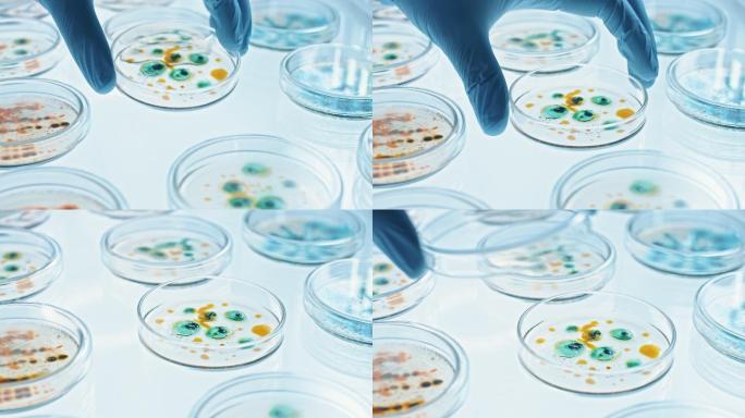 这位科学家用培养皿处理各种细菌、组织和血液样本