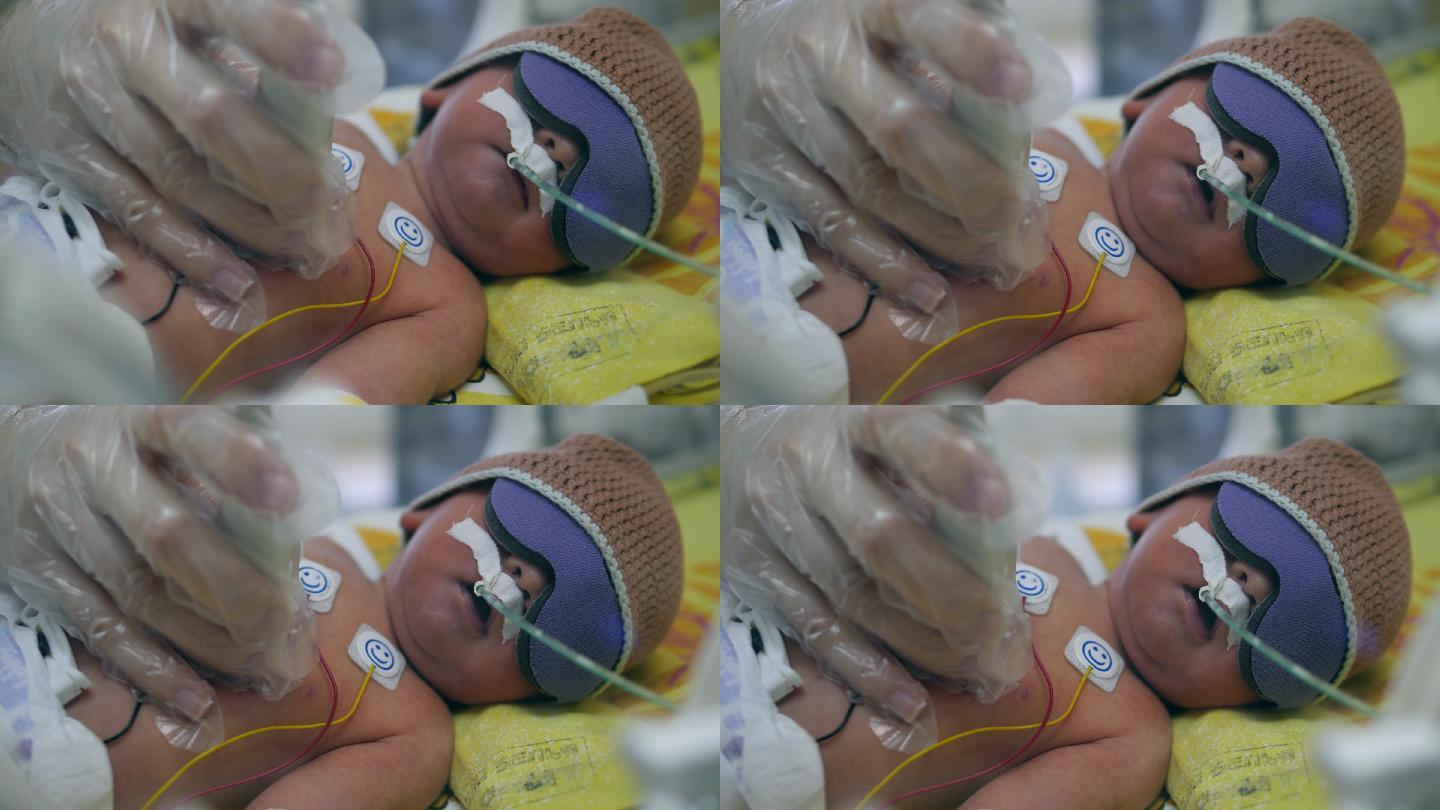 新生儿正在接受医疗控制下的超声波检查