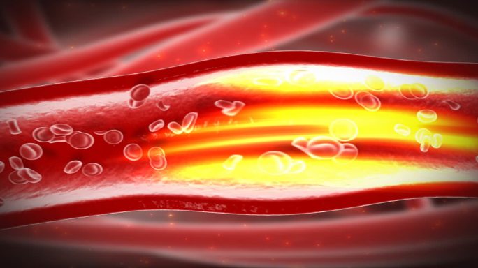 冲刷血管 溶栓降压 清脂 血液 血脂垃圾