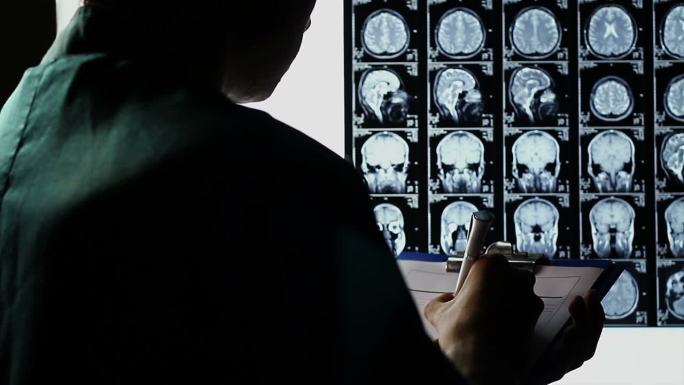 检查脑部X光扫描，做笔记，做出诊断