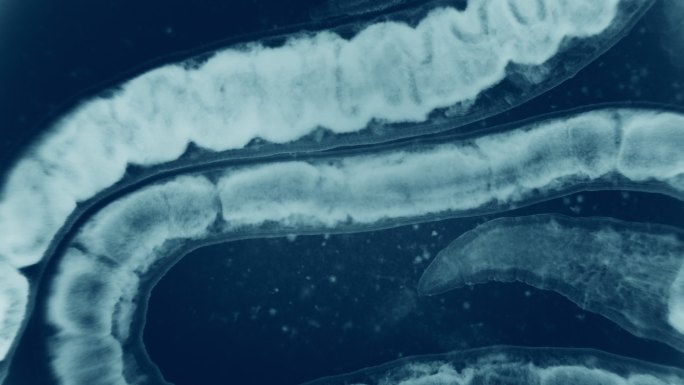 显微镜下的血虫医学生物学自然