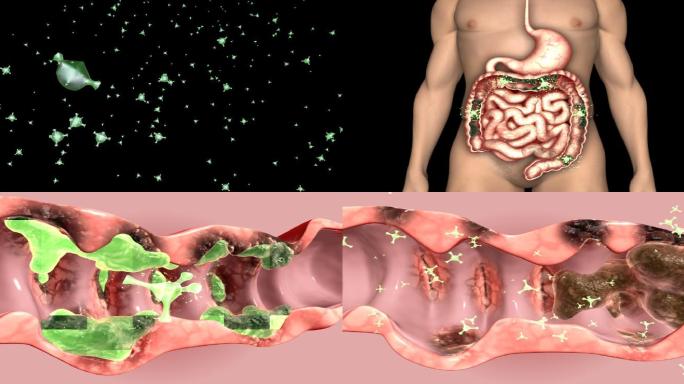 带通道肠道垃圾 吸收 养分 益生菌