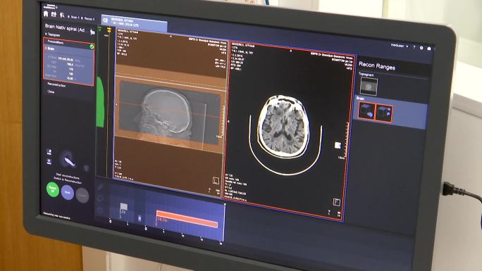 脑断层扫描人体内部器官计算机显示器设备屏
