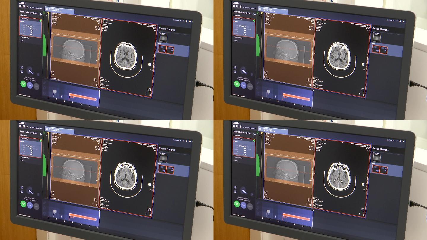 脑断层扫描人体内部器官计算机显示器设备屏