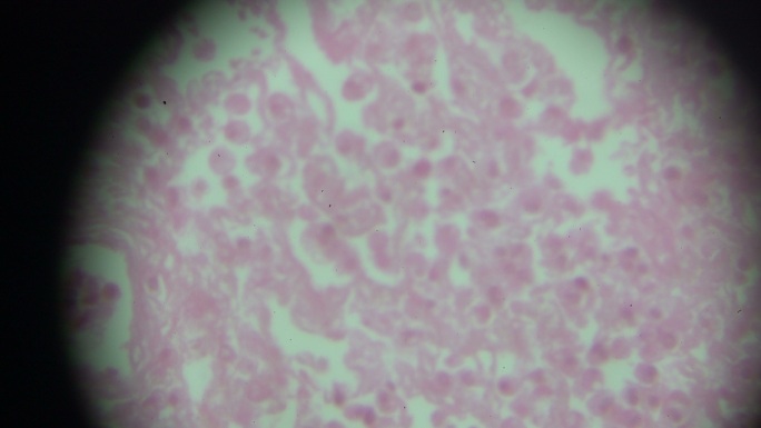 显微镜下的浆细胞