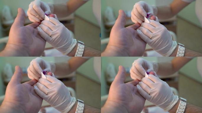 病人在医院检查时接受手指点刺血试验