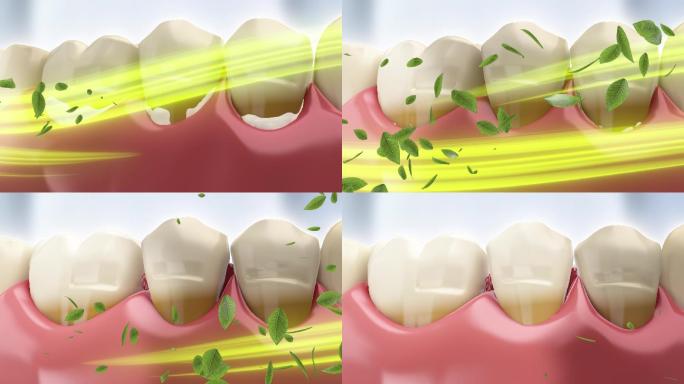 清除牙结石修复牙龈
