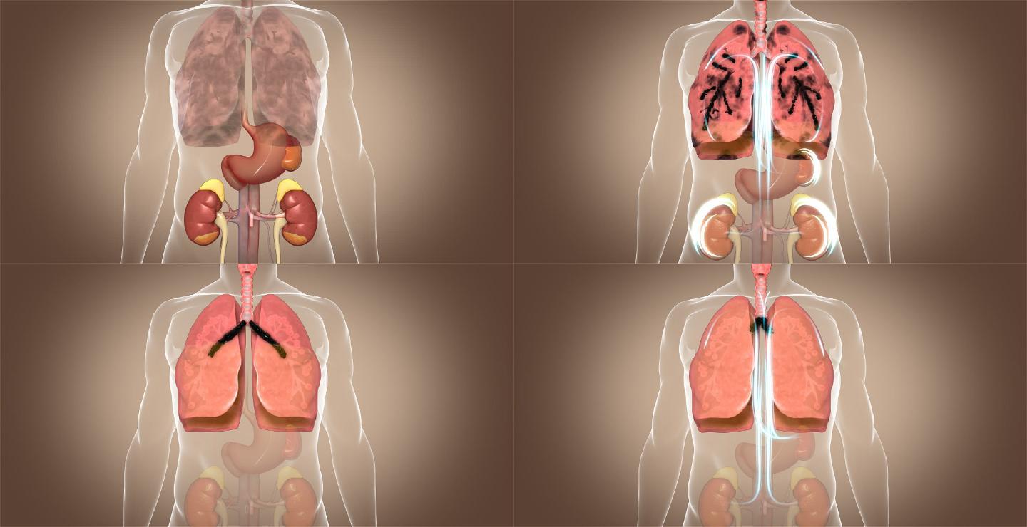 补肺 润肺 肺 肺部呼吸 呼吸系统肺炎