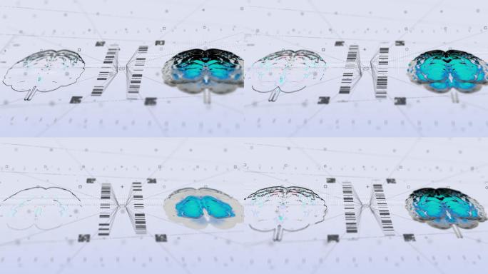 脑磁共振技术扫描受体云计算图形用户界面