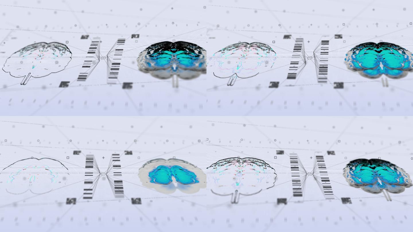 脑磁共振技术扫描受体云计算图形用户界面