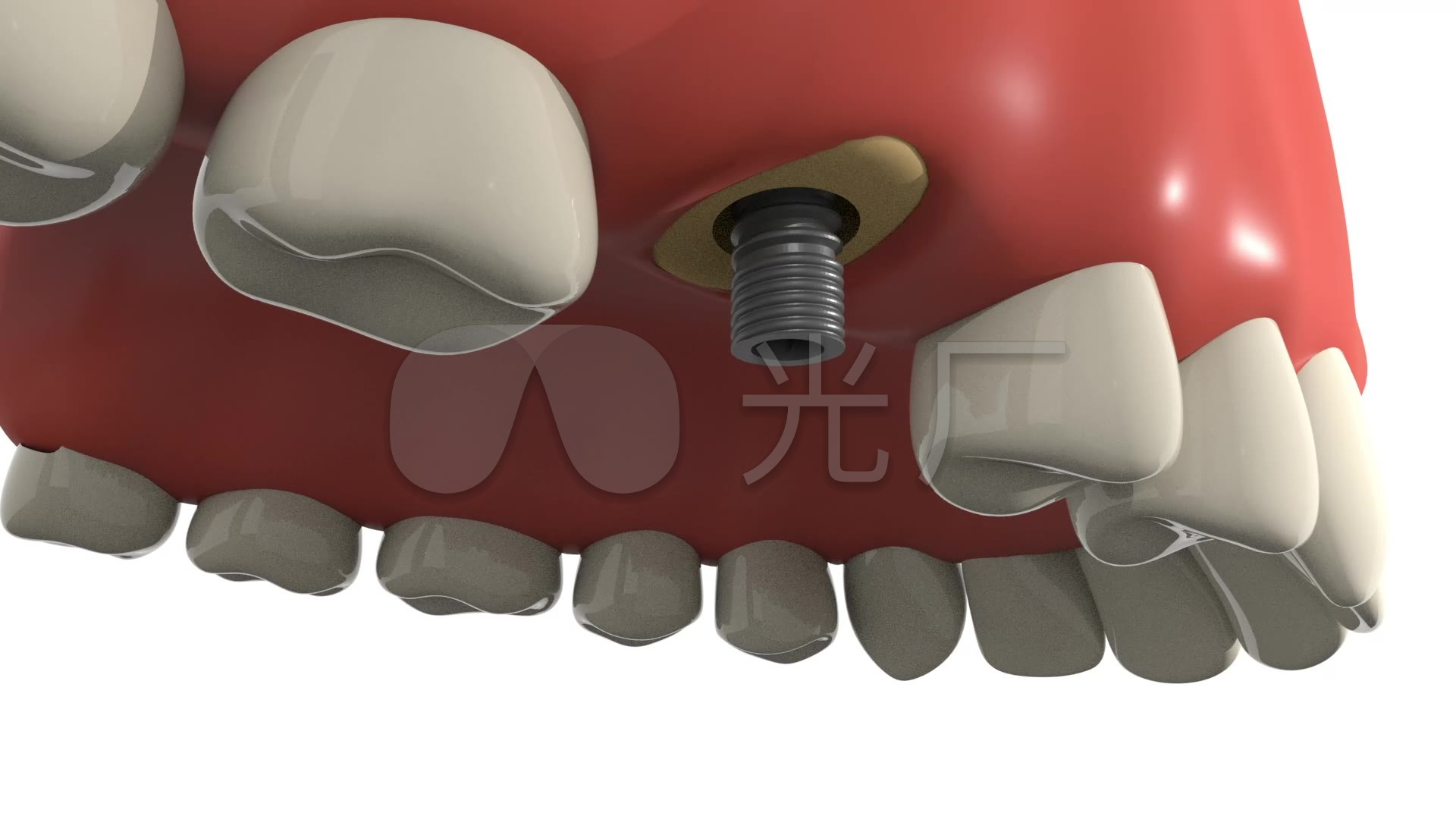 森川精密|右上后牙区的工作体位及口镜使用技巧 - 佛山市森川精密器械有限公司