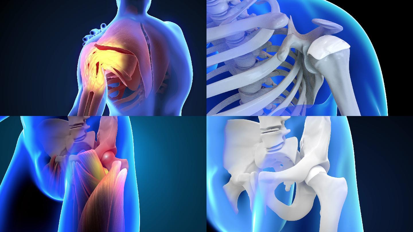 关节病变透视视频