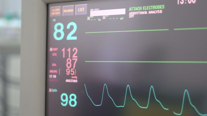 医疗设备生命体征筛查