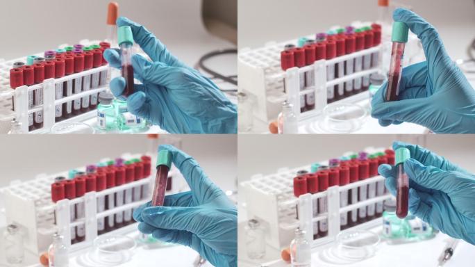 科学家摇动和混合血液试管